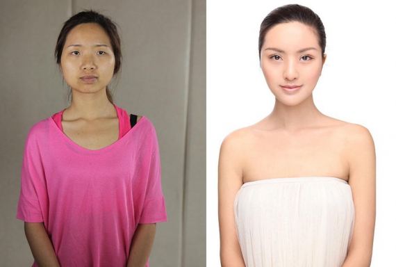 26-летней преподавательнице танцев Лиу Йисонг не нравились форма ее глаз, приплюснутый нос, узкий лоб и круглая форма лица.