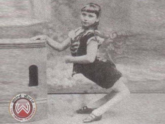 Элла Харпер, известная как «Человек-верблюд».