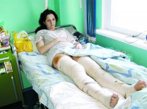 Анастасія Сіленок лежить у Черкаській обласній лікарні. Глибокі рани на ногах гоїтимуться щонайменше місяць