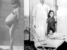 Наймолодша мама.  Коли в 1933 році в лікарню в Перу надійшла Ліну Медіну, 5,7 років, лікарі запідозрили у неї пухлину в черевній порожнині. Але при огляді виявилося, що дівчинка ... вагітна. Через півтора місяці на світ з'явилася здорова дитина вагою 2,7 кг.  Виявилося, що дівчинка досягла статевого дозрівання в 4 роки. А ось хто її запліднив, вона так і не зізналася.