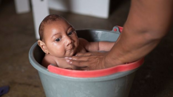 Заражені вірусом Зіка немовлята мають маленьку голову та розвиваються повільніше.
