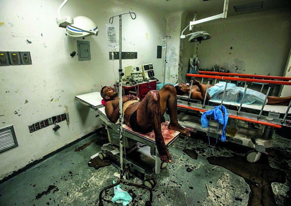 Хосе Вілларойл лежить в операційній лікарні Пуерто ла Круз. Чоловікові прооперували органи черевної порожнини. Торік через зламані вікна до відділення для новонароджених залізли опосуми. Загризли 17 малюків