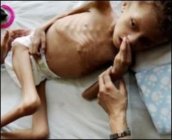 143 миллиона детей в возрасте до пяти лет хронически недоедают