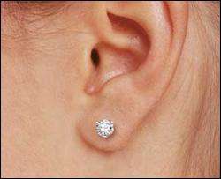 Как пирсинг мочек ушей может повлиять на здоровье
