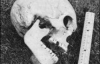 У Грузії знайдено скелет 3-метрової людини