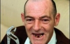 Ветеран іракської війни вирвав собі 13 зубів пласкогубцями (ФОТО)