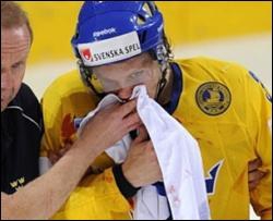 Хоккеист сборной Латвии сломал челюсть шведскому защитнику (ВИДЕО)