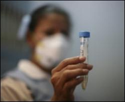 В России появилось еще одно подозрение на свиной грипп