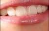 Стоматологи розкрили &quot;секрет&quot; здорових зубів