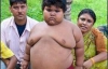5-летняя Суман Кхатун весит 76 килограммов