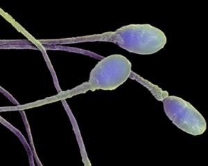 Сперматозоїди вміють розрізняти своїх &amp;quot;родичів&amp;quot;
