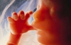 Після аборту хлопчик залишався живим іще два дні