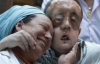 В Испании мужчине пересадили новое лицо (ФОТО)