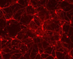 Вчені навчилися відновлювати нервові клітини