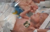 Хлопчик народився на п"ятому місяці вагою 610 грамів