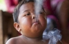 Двухлетний мальчик выкуривает по 40 сигарет в день (ФОТО)