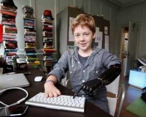 Ребенок-робот первый в мире пользуется рукой-протезом лучше, чем родной (ВИДЕО)