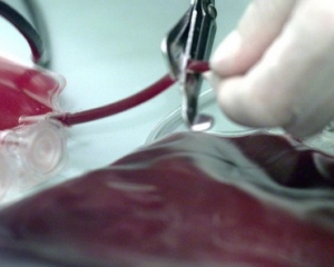 В Канаде Учены научились делать кровь из кожи
