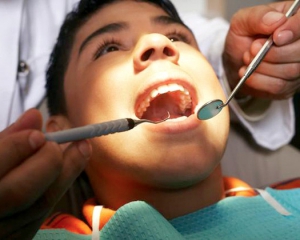 Стоматологи склали список продуктів і звичок, які руйнують зуби