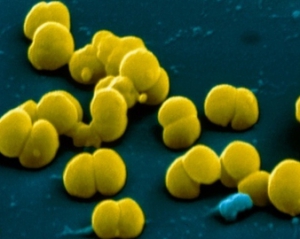 Закарпатских цыган поразила смертельная инфекция