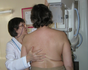 Лікарі розповіли, як зменшити ризик розвитку раку грудей