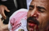 Полиция Йемена убила 30 мирных демонстрантов