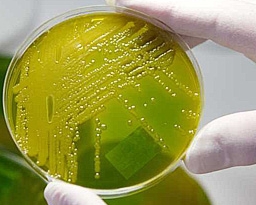 Смертоносну бактерію E.сoli випустили терористи?