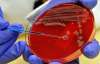 Бактерия E.coli во Франции: кровавую диарею вызвали бифштексы