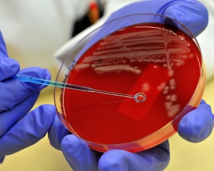 Бактерия E.coli во Франции: кровавую диарею вызвали бифштексы