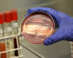 Бактерія E.сoli вже вбила 50 людей