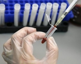 ДНК-аналіз на батьківство коштуватиме 6 тисяч гривень
