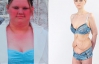 Самая толстая британка умирает от анорексии