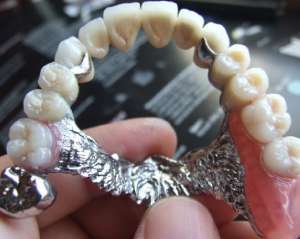 Зубы решили печатать на 3D принтере