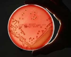 Бактерии в организме &quot;засветятся&quot;