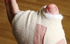 Хірурги пересадили чоловіку палець ноги замість відрізаного пальця руки 