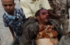 Влада Ємену обстріляли ракетами протестантів