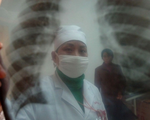 Вихователька дитсадку на Луганщині хворіла на відкриту форму туберкульозу
