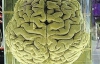 Мозок Ейнштейна виставили в музеї Філадельфії