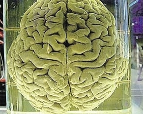 Мозг Эйнштейна выставили в музее Филадельфии