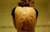 Мастер татуировки отомстил экс-возлюбленной рисунком экскрементов на спине