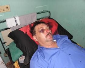 Головному борцеві з бракон&#039;єрами на Львівщині відбили нирки