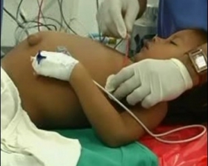 3-річний хлопчик виношував у животі свого брата-близнюка