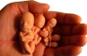 156 тыс. официальных абортов зафиксировано в прошлом году, одна женщина умерла