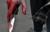 На Харківщині міліціонерові за зауваження порізали обличчя