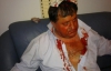 Избитого во время драки в парламенте "бютовца" прооперировали