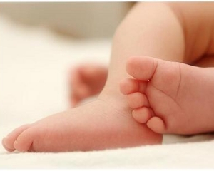 Сіамські близнюки з Краматорська мають одне серце на двох