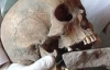 Скелет 15 века с кирпичом во рту вызывал споры ученых