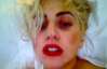 Леди Гага никак не отойдет после сотрясения мозга