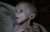 В Донецке заморили голодом шестимесячную девочку
