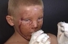 На Донеччині 9-річний хуліган ледь не загинув, кидаючи каміння по поїздах